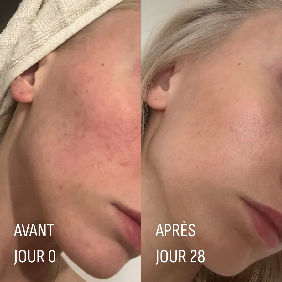 peau transformée en 28 jours